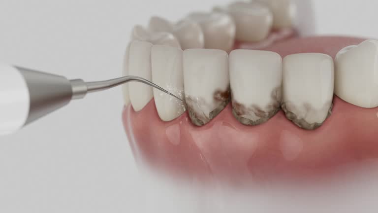 Reliable Emergency Dentist contractor in Napoleon, OH by Smile Center Dentistry